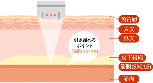 皮膚断層