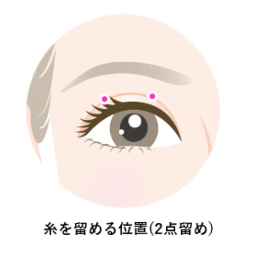 糸を止める位置(2点留め)