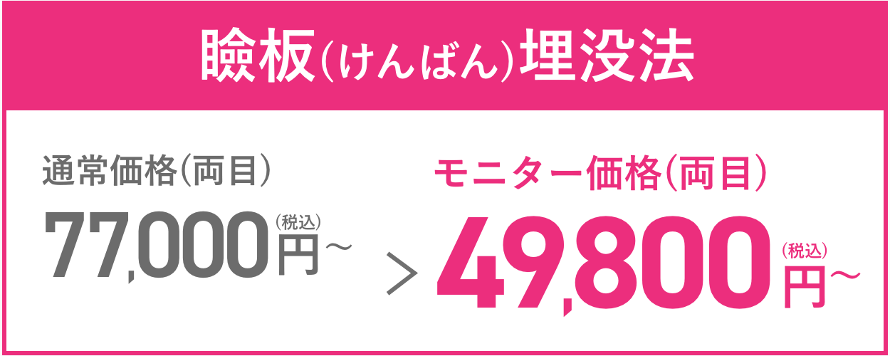 瞼板(けんばん)埋没法 通常価格(両目)77,000円(税込)~→モニター価格(両目)49,800円(税込)
