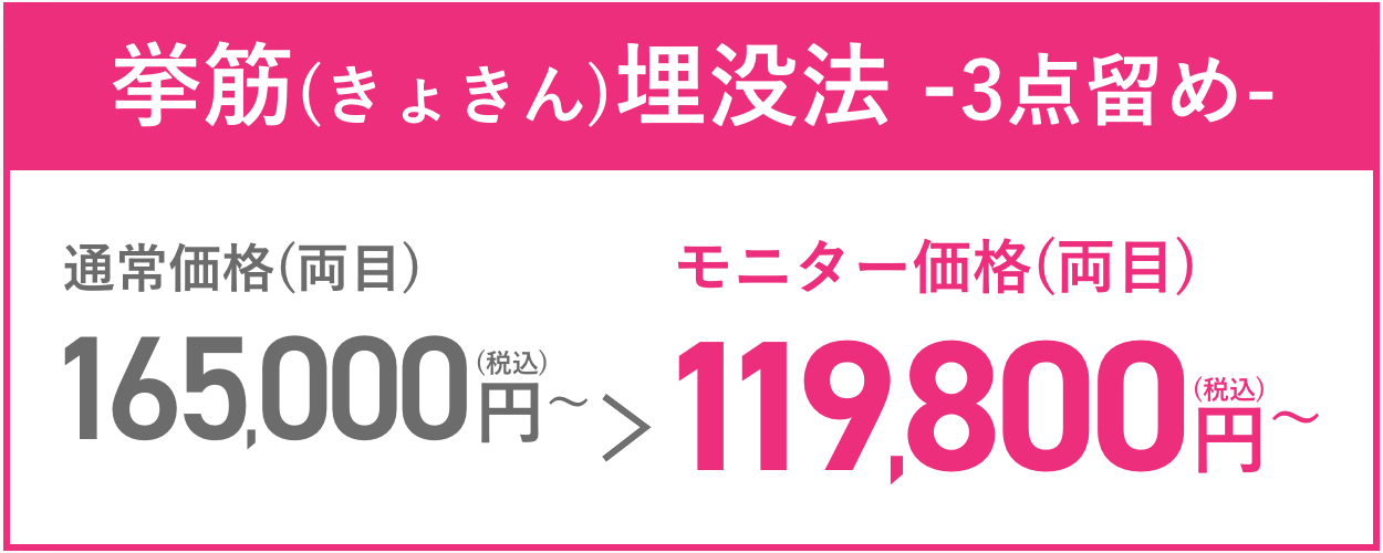 瞼板(けんばん)埋没法-3点留め- 通常価格(両目)165,000円(税込)~→モニター価格(両目)119,800円(税込)