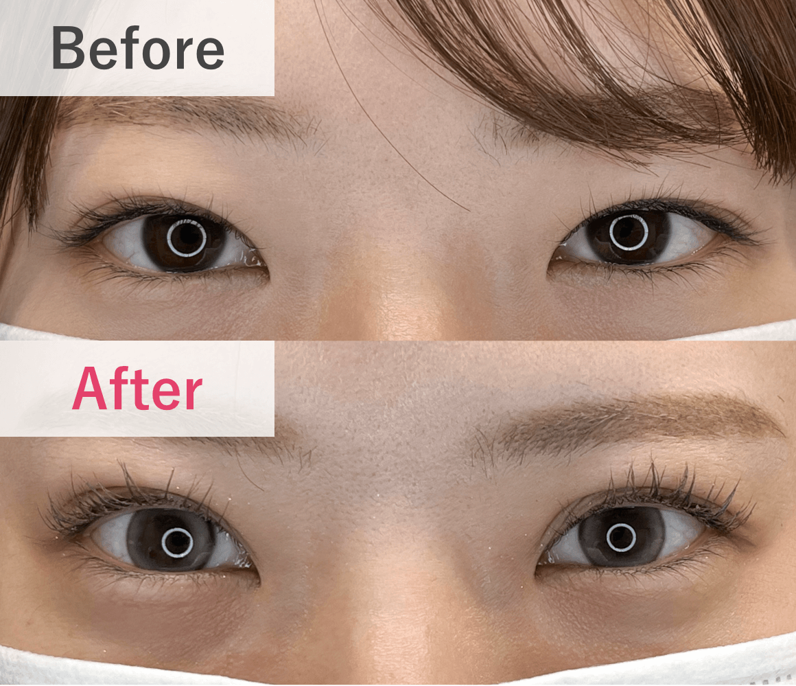 症例実績 Before After