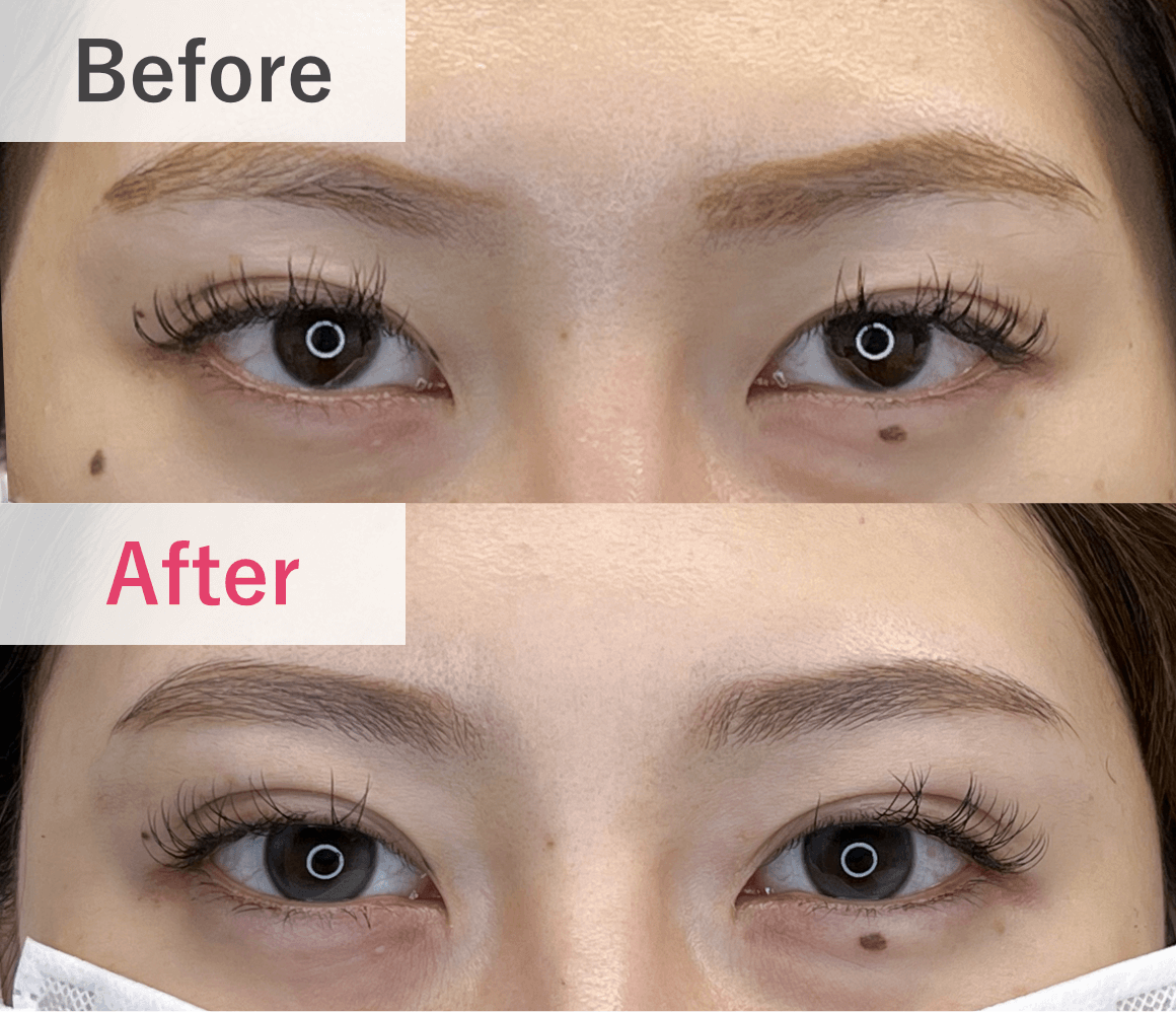 症例実績 Before After