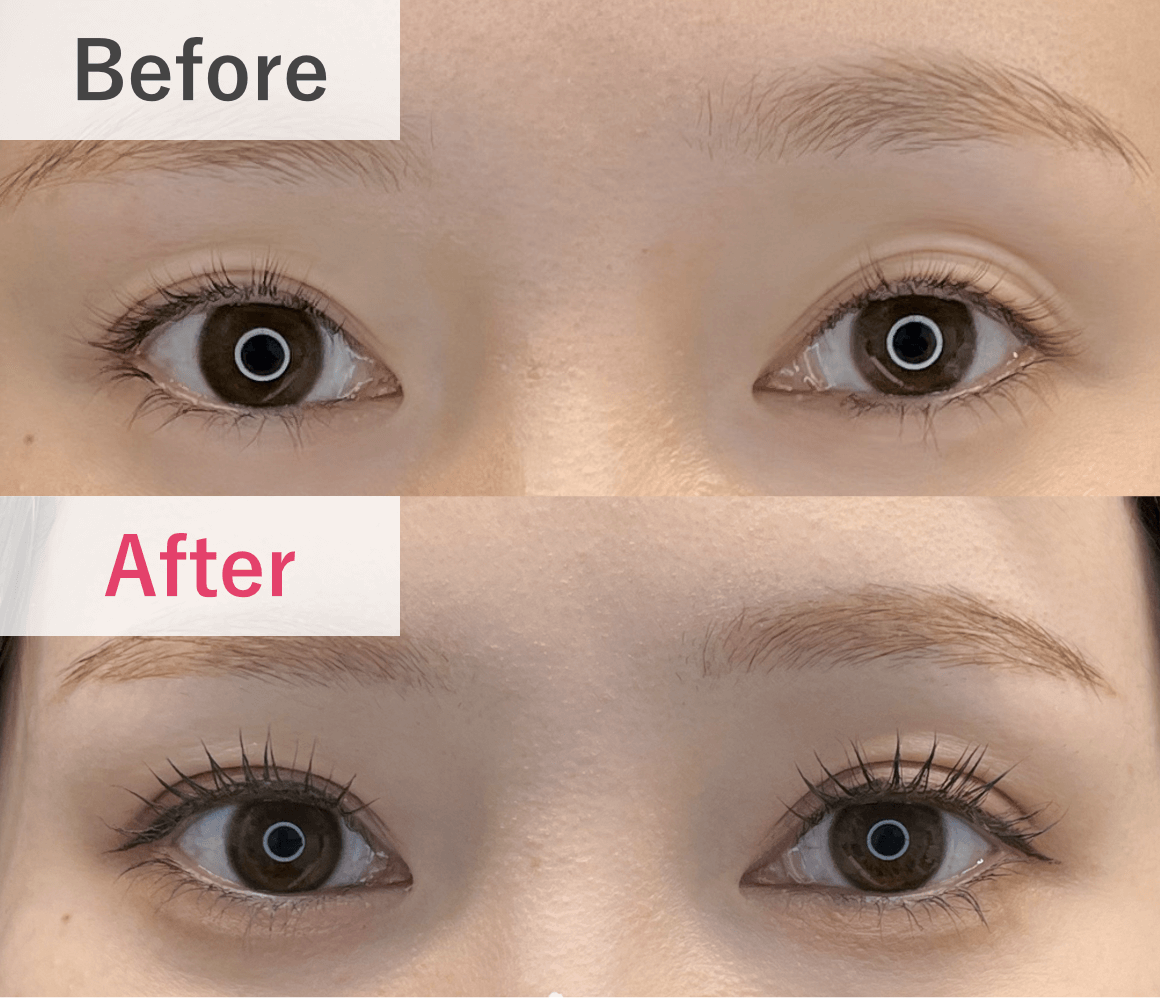 症例実績 Before After