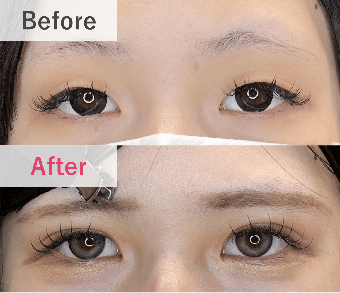 症例実績 Before After