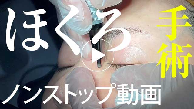 施術動画サムネイル