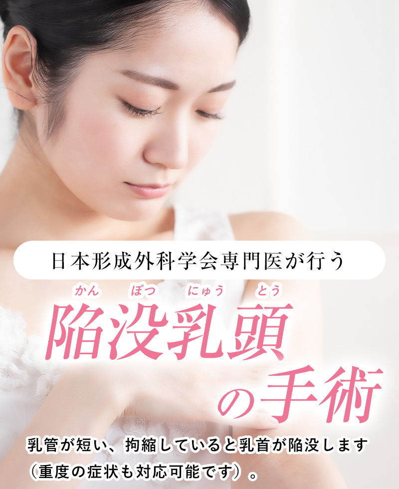 日本形成外科学会専門医が行う陥没乳頭の手術