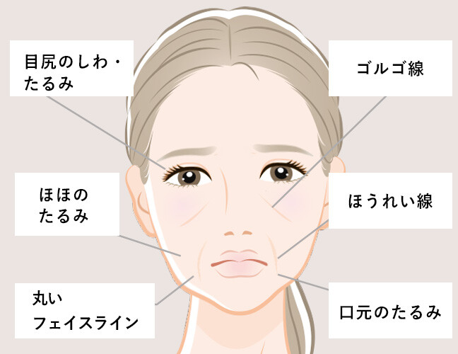 上まぶたの重なり 目尻付近のしわ・たるみ 下まぶたのたるみ ほほのたるみ 丸いフェイスライン ゴルゴ線 ほうれい線 口元のたるみ あごのたるみ