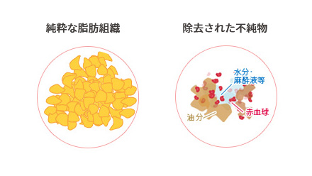 純粋な脂肪組織のイメージ