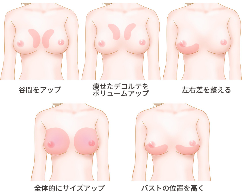 バストの位置や輪郭で印象が変わるイメージ