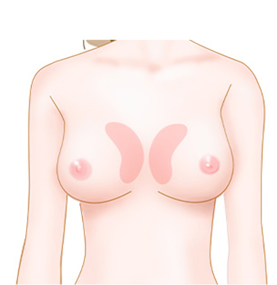 谷間をアップするデザインのイメージ