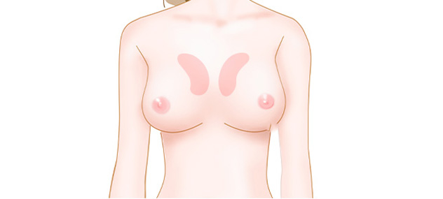 やせたバストのイメージ