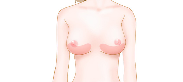 下垂したバストのイメージ