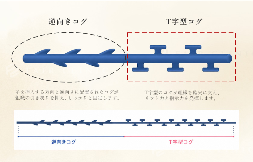 Dooth threadの2種類のコグを一つの糸に配置した構造のイメージ
