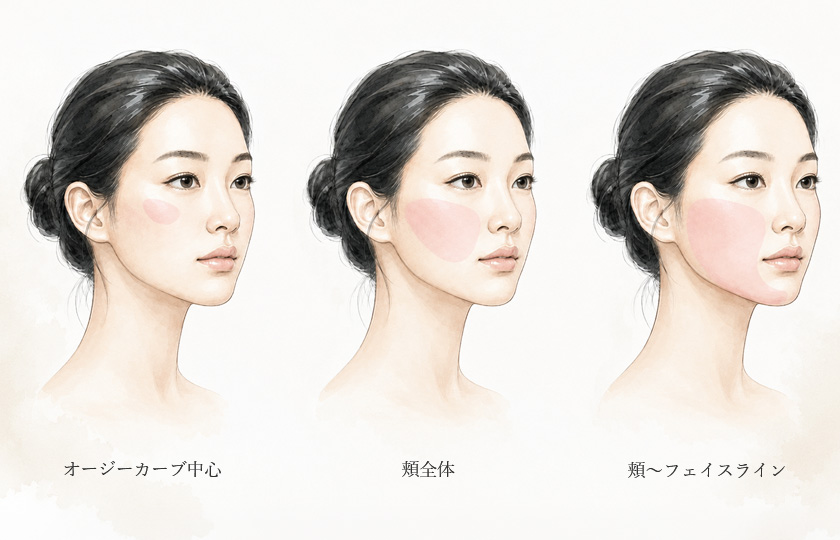 必要な範囲に合わせて糸の本数を選ぶイメージ