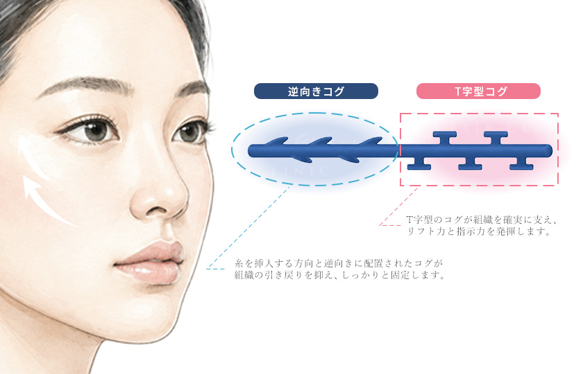 Dooth threadのイメージ