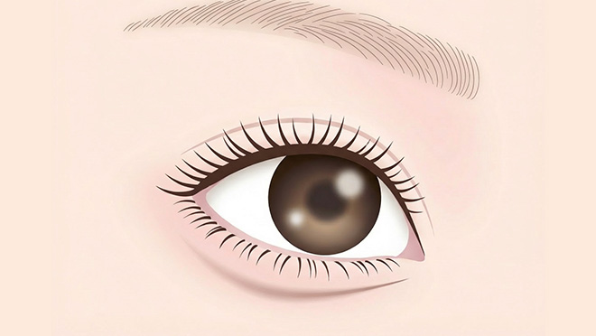 注入治療が向いているケースのイメージ