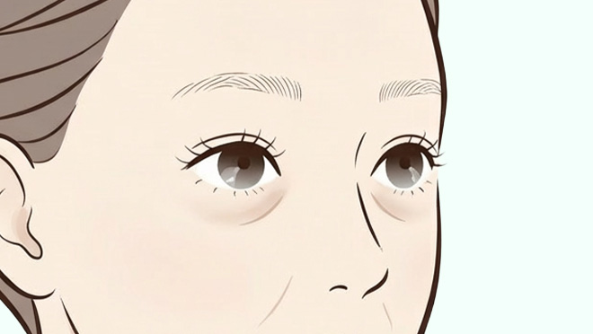 目の下のくぼみイメージ