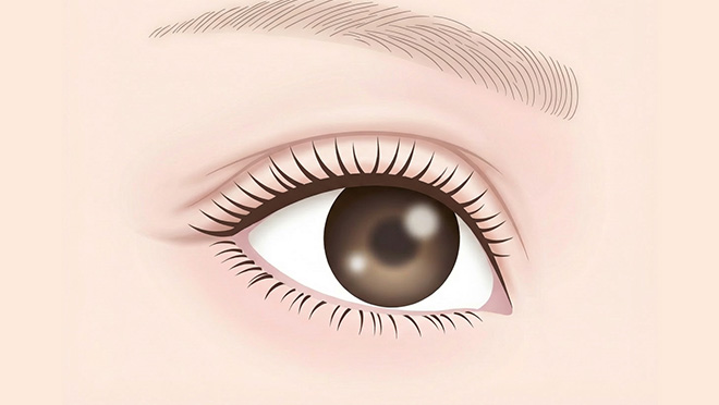 上眼瞼除皺術のイメージ