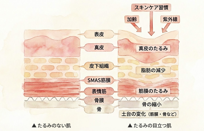 老け見えの原因が重なるイメージ