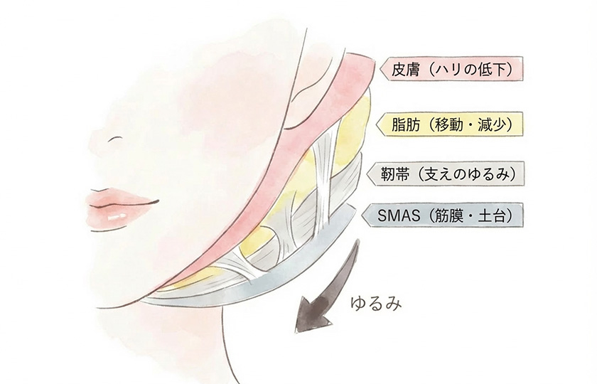 顔のたるみが層ごとに起こる仕組み（皮膚・脂肪・靭帯・SMAS）のイメージ