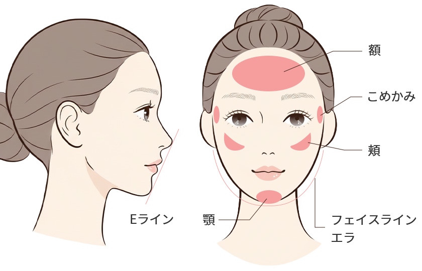 小顔・輪郭治療の代表的なパーツ