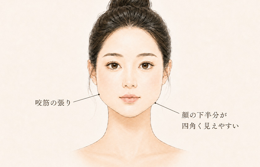 咬筋の張りにより顔の下半分が四角く見えやすい状態のイメージ