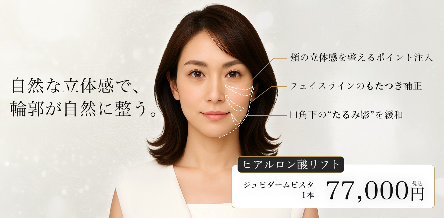 注入によるリフトアップ治療 自然な立体感で、輪郭が自然に整う。