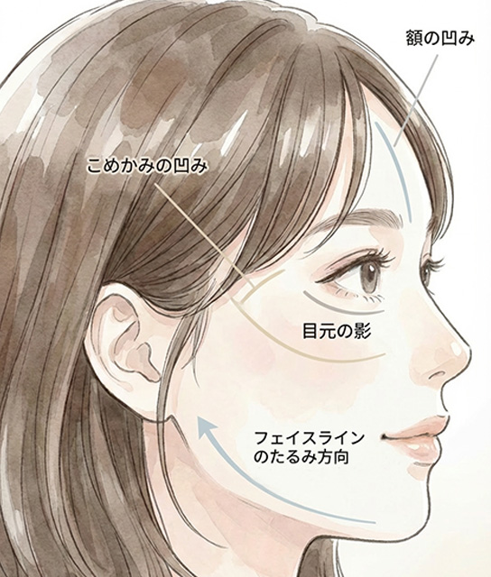 他のたるみ治療と比較しながら提案するイメージ