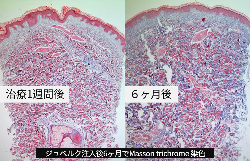 体内に残らない成分設計のイメージ