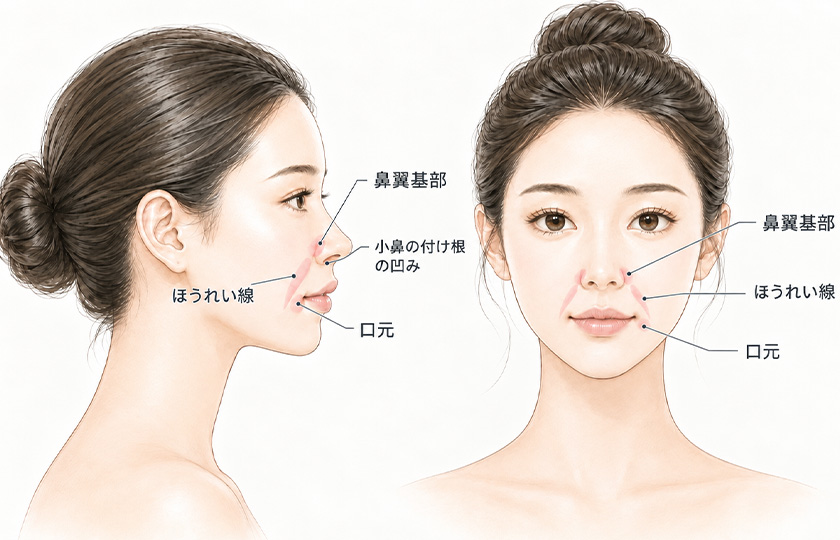 鼻翼基部とほうれい線、口元の位置関係を示すイメージ