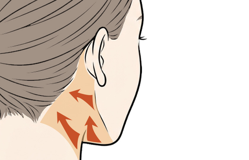 広頚筋の処理イメージ