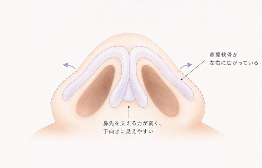 鼻先の軟骨が細い、または左右に広がっているタイプのイメージ
