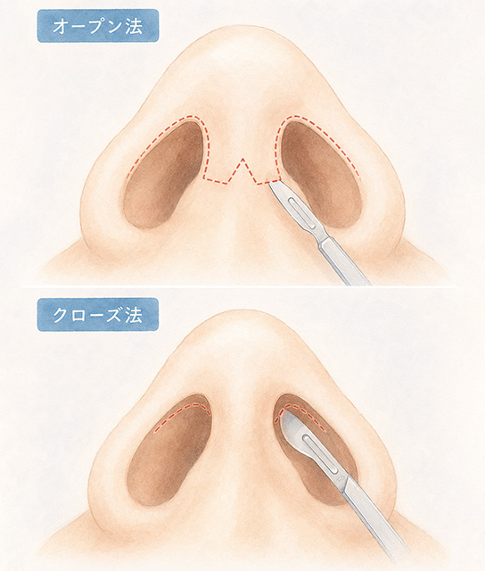 術式を比較するイメージ