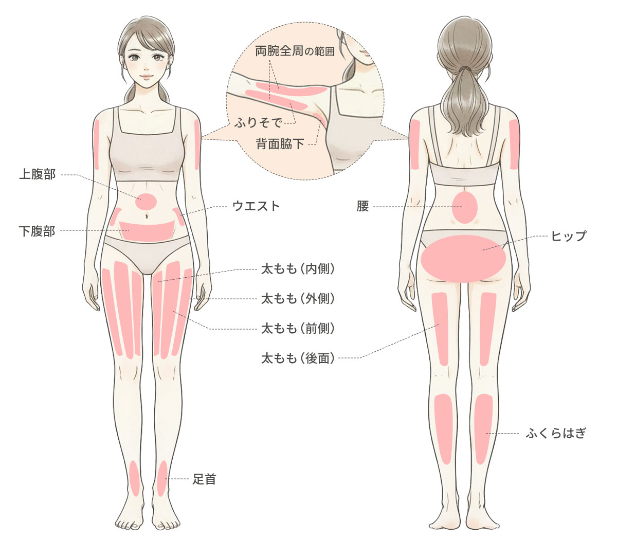 脂肪吸引の対応部位一覧