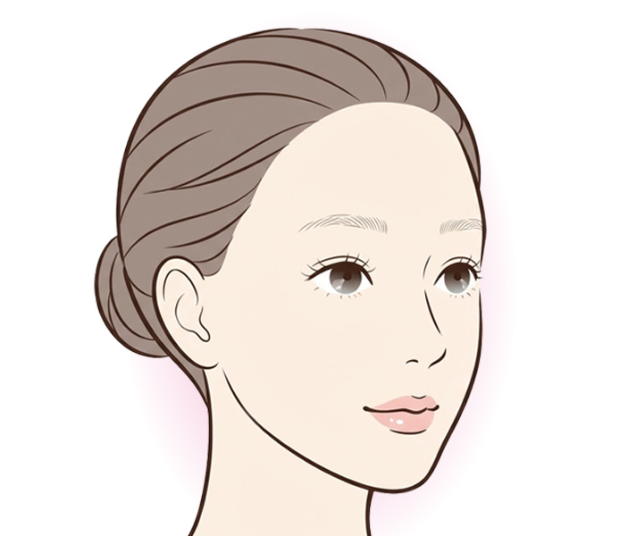 脂肪吸引後のフェイスラインのイメージ