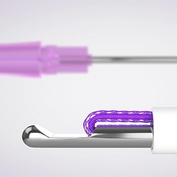 糸リフトのイメージ