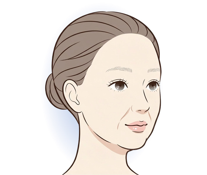 フェイスラインのたるみのイメージ