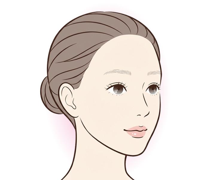 TESSリフト後のフェイスラインのイメージ