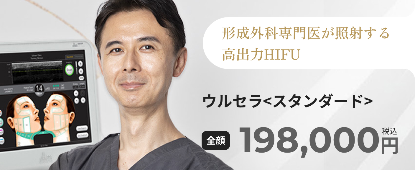 ウルトラセルのバナー