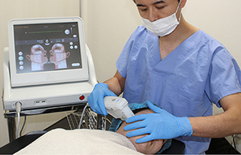 HIFU（医師施術HIFU治療／HIFU治療）のイメージ