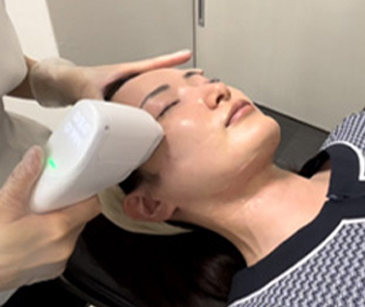 フェイスラインのたるみのイメージ