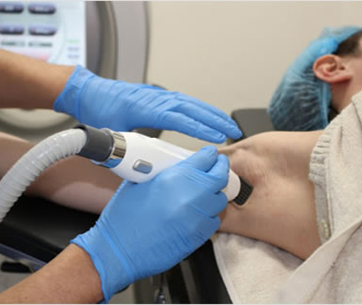 ビューホット照射イメージ