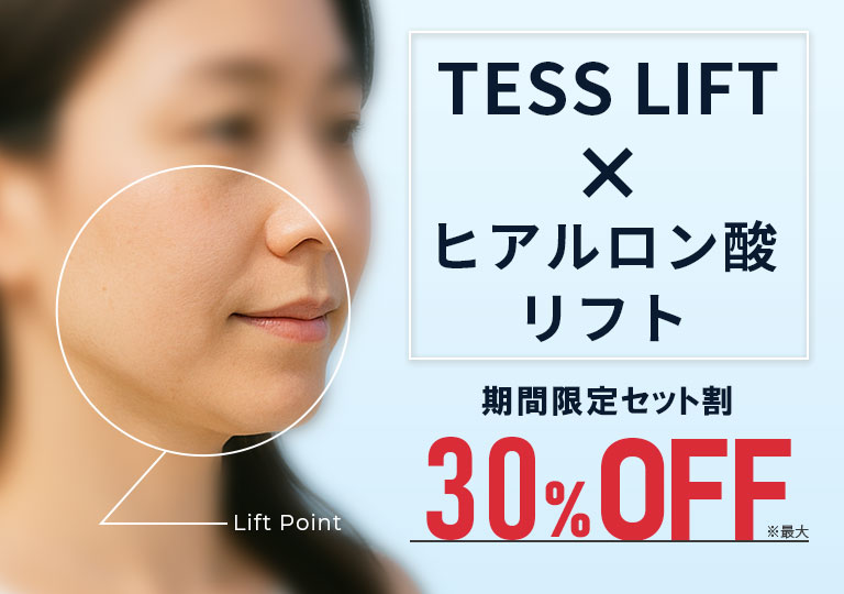 終了：【先着30名様】TESS LIFT ＆ ヒアルロン酸リフト キャンペーン開催中！