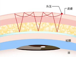 TCB線留め1本 1dayクイックアイプレミアムエタニティEX