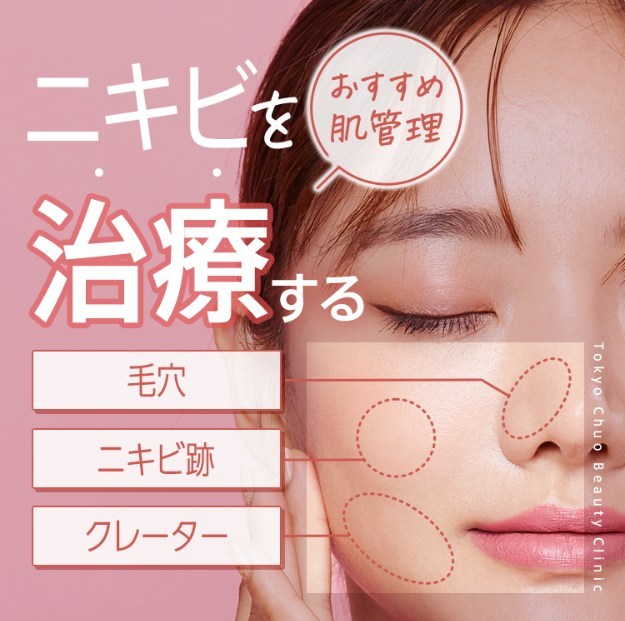 TCB東京中央美容外科のニキビ治療
