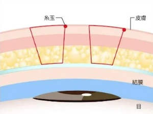 TBCスクエア留め1dayクイックアイナチュラル 1dayクイックアイエタニティ