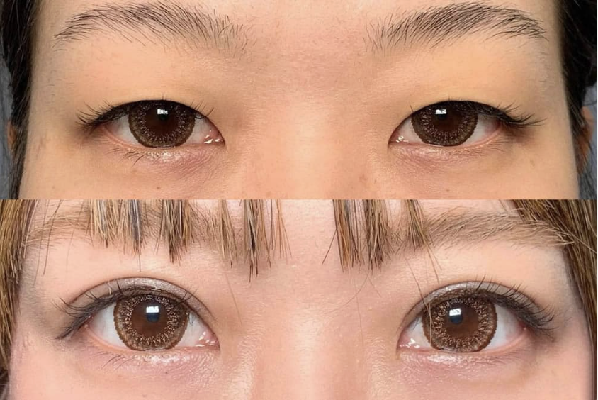 まぶたのクリニック