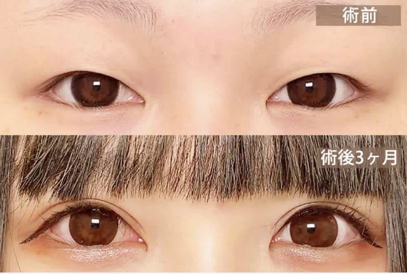 まぶたのクリニック