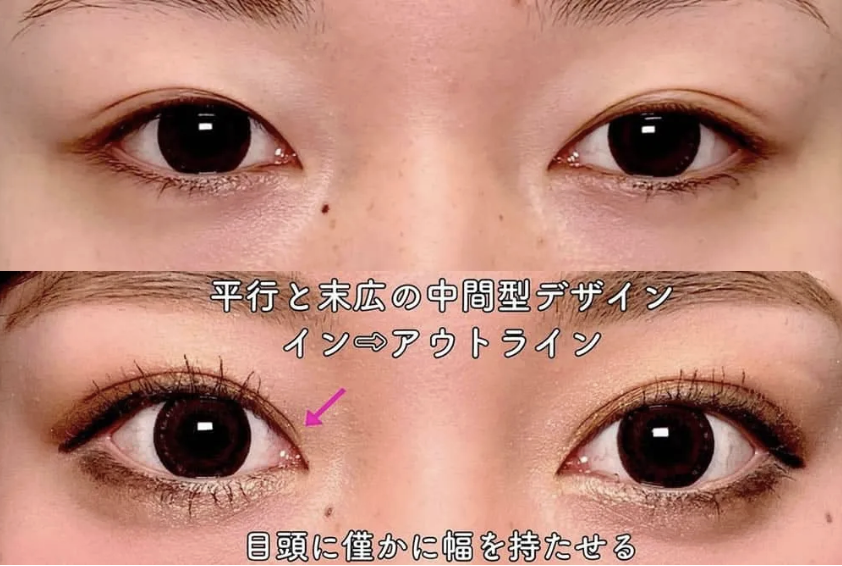 まぶたのくりにっく