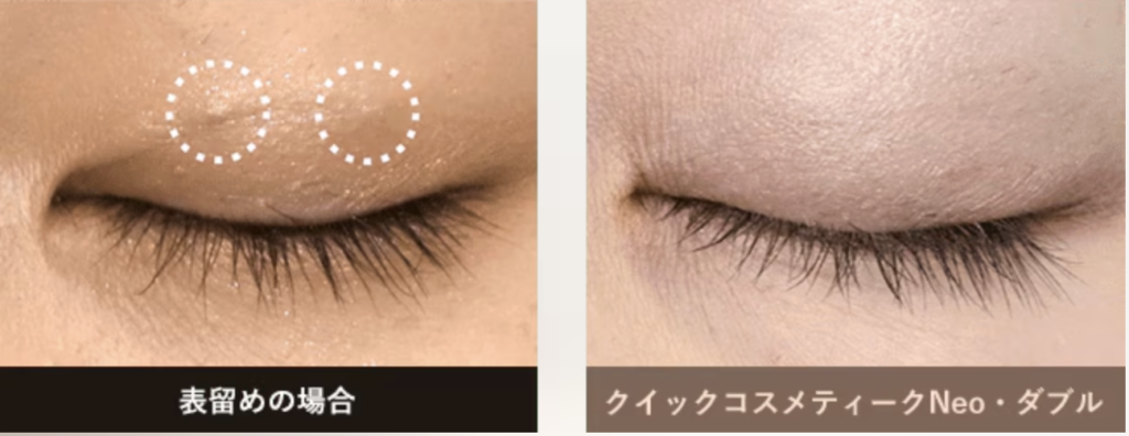 クイックコスメティーク・ダブル